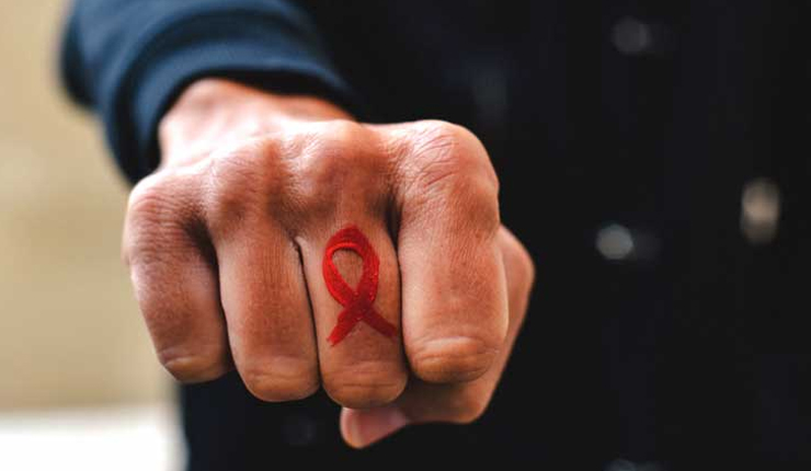 HIV/ AIDS – SAQA : 13915